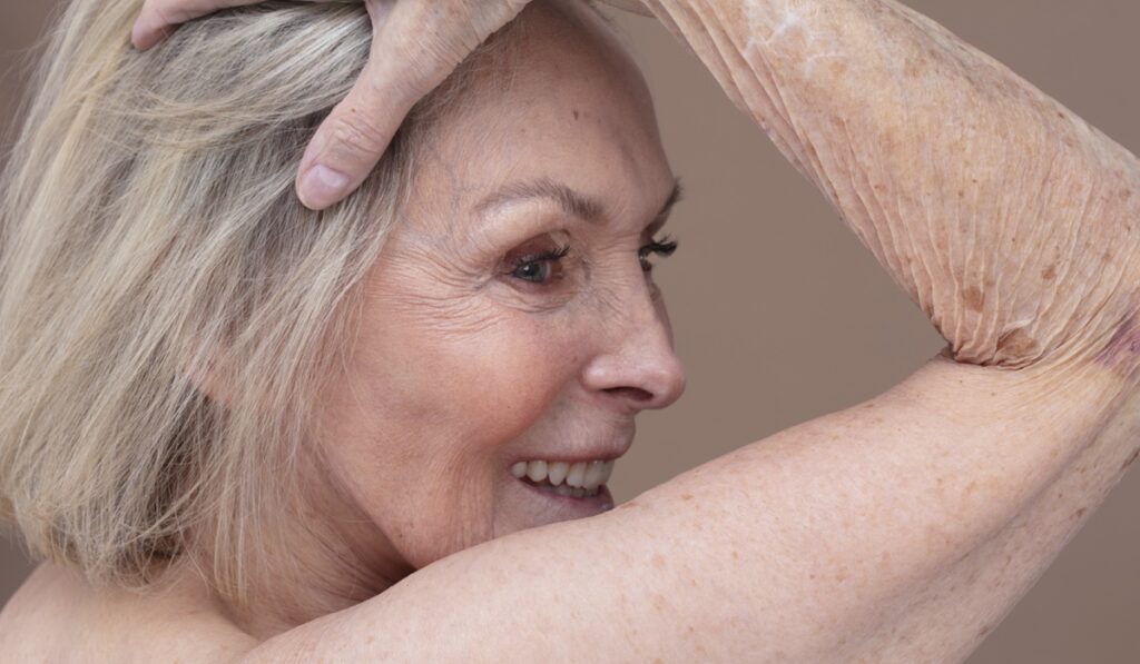 skin conditions in the elderly