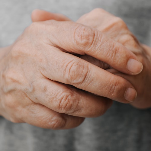 arthritis in older adults